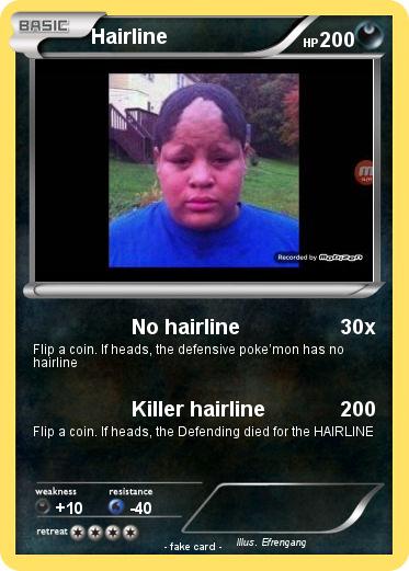 Pokemon Hairline